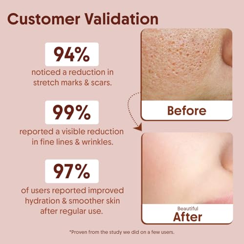Image of Aravi Organic Vitamin E Oil For Face - Best Oil For Body and Nail - Enriched Veg Vitamin E Source - For Nourish Your Face and Repair Damaged Skin - 30 ml