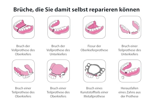 Zahnzement Clicadent für Zahnersatzreparatur