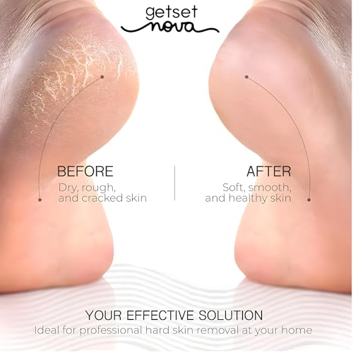 Image of Callus Remover for Feet - Electronic Foot Scrubber & Dead Skin Remover - Pedicure Machine Foot Spa - Foot Crack Remover Machine, Foot Scraper for Dead Skin, Foot Cleaner, and Foot Care Tools