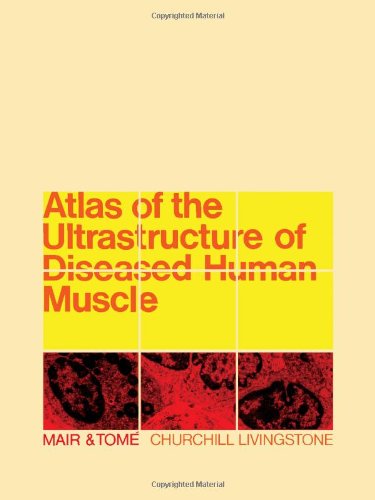 Buy Atlas of the Ultrastructure of Diseased Human Muscle — BookShops.in