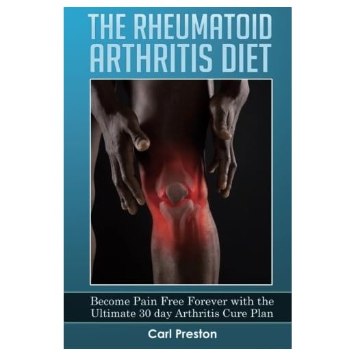 The Rheumatoid Arthritis Diet: Become Pain Free Forever with the Ultimate 30 Day Arthritis Cure Plan (Arthritis, Rheumatoid Arthritis Treatment, ... Joint Inflammation, Osteoarthritis Diet)