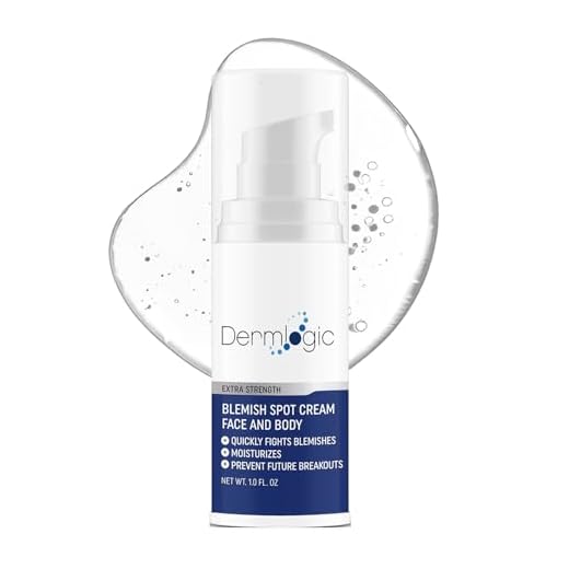 Acne Face & Body Cream- Maximum Strength Treatment for Cystic, Blackhead & Whitehead Pimples. Prevents Future Breakouts. Use on Face, Body, Chest & Back for Teens & Adults. 