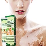 crema para vitiligo peru ● Natural y segura: esta crema de vitiligo está hecha de hierbas naturales y suaves, y los ingredientes naturales son seguros y suaves, sin efectos secundarios. Se puede utilizar con confianza. Puede ayudarte a reparar lentamente la melanina que la piel se perdió originalmente.