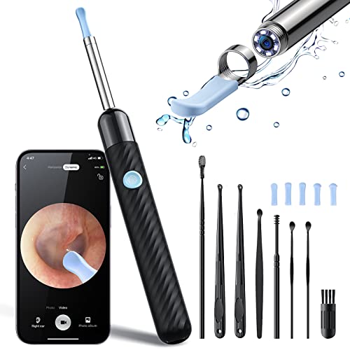 10 Best Earwax Removal Kit With Camera Review And Buying Guide