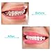 20 Pieces Aligner Tray Seaters for Aligner Trays Chompers Orthodontic Trays(Light Pink, Red, Green, Lavender, Light Yellow)