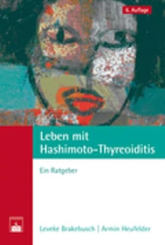 Leben mit Hashimoto-Thyreoiditis: Ein Ratgeber