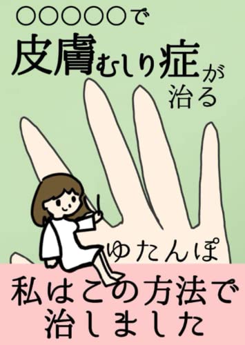 ○○○○○で皮膚むしり症が治る: 私はこの方法で治しました (Japanese Edition)