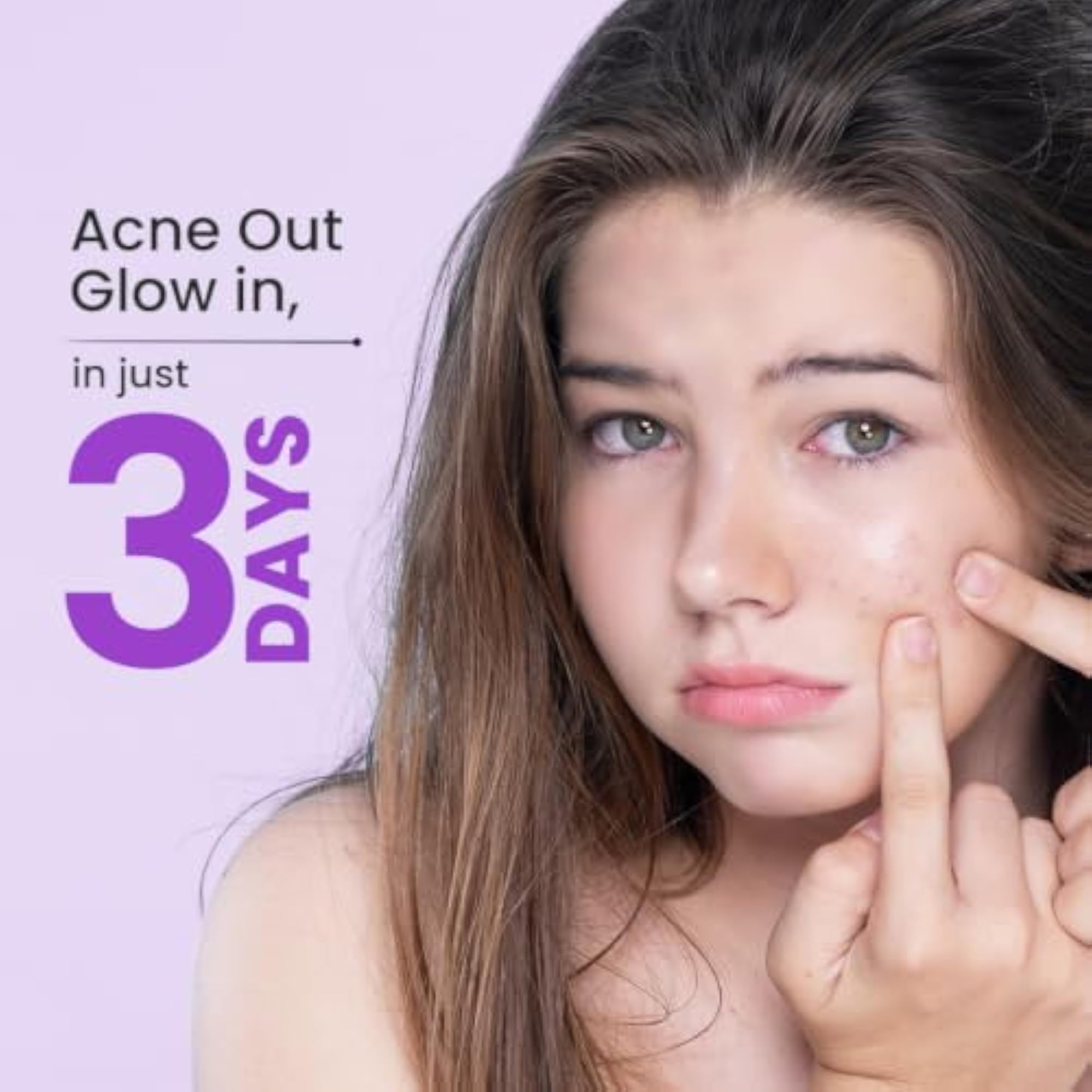 Pimple Care Soap for Acne, Blemishes & Dark Spots