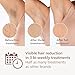 Philips Lumea IPL Prestige, 2 Attachments - Hair Removal Device (BRI944/00)
