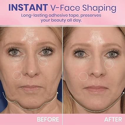 Image of Vita-A Retinal Shot Tightening Booster Serum, 0.1% Retinal, Matrixyl 3000 5%, Panthenol 1%, Pore Minimizer, Anti-Wrinkle, 15ml (V shaped Mask Invisible Tape)