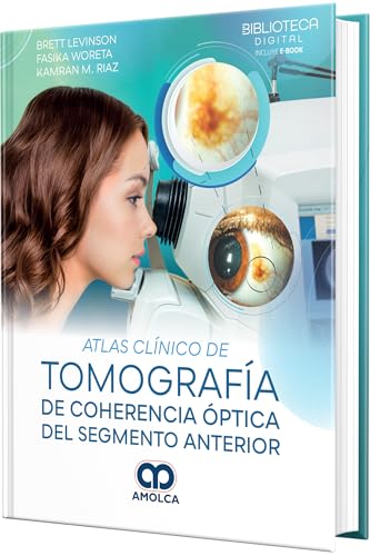 Atlas Clínico de Tomografía de Coherencia Óptica del Segmento Anterior