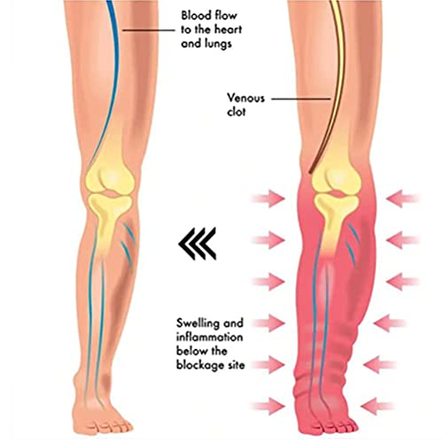 Kylewo Braccialetto magnetico per drenaggio