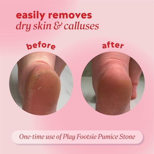 Onyx Professional Double Sided Pumice Stone, 2 Pack - 100% Siliglass Callus Remover for Feet, Elbows, Knees, Dead Skin, Heels, Hands, Foot File Scrubber Exfoliator, Pumice Stone for Feet - Image 4