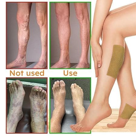 GROSSAMER Turmeric Varicose Vein Patch | Herbal Relief Patches for Legs Swelling Spider Veins and Fatigue Support varicose veins | Pain Relief and Swelling Reduction, Blood Circulation Support (4 Pack) - Image 5 thumbnail
