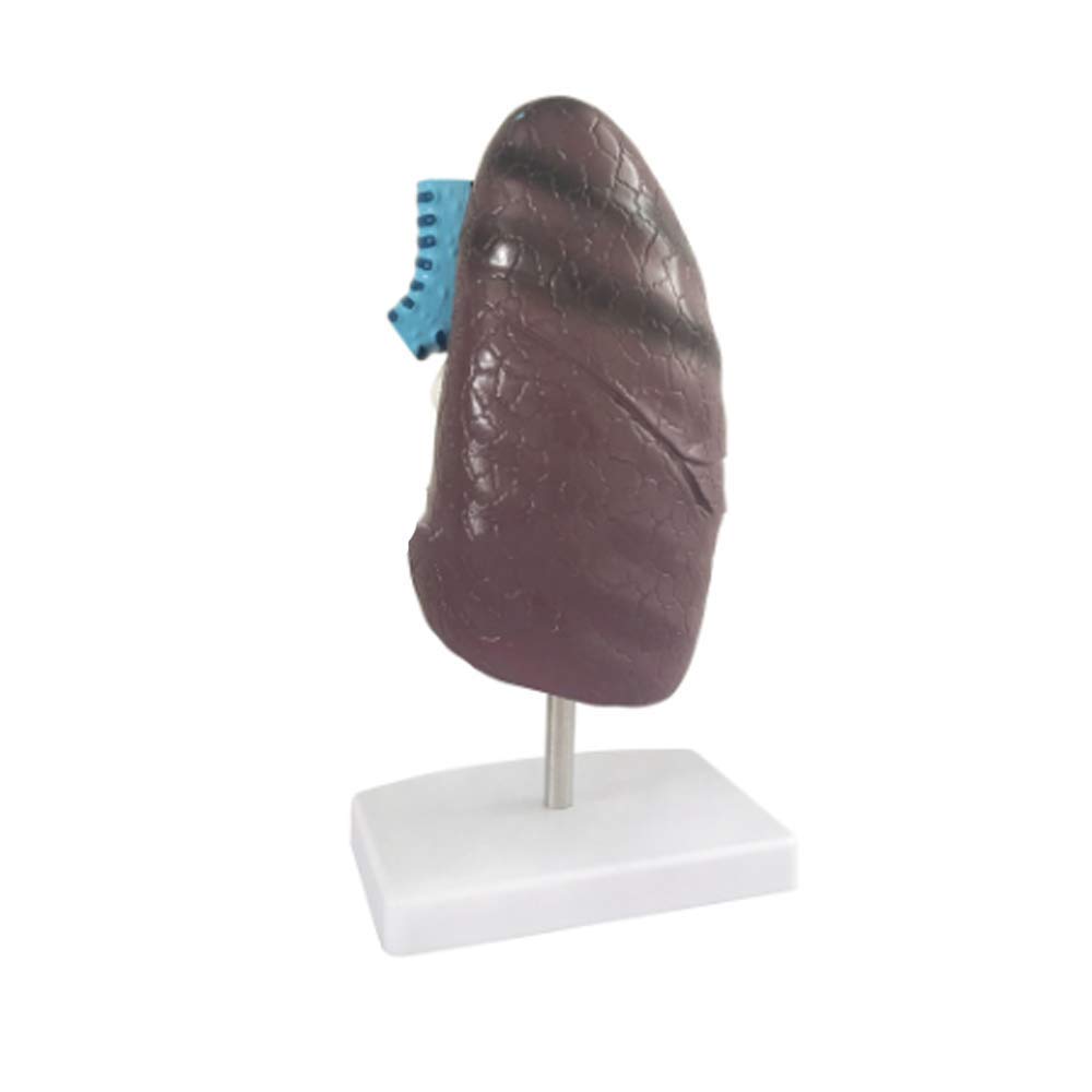 Zusammenbau-Montagemodell, Anatomie-Modell, Lungenorgan, menschliches pathologisches anatomisches Atmungssystem, Modell für Medizin, Biologie, Labor, Wissenschaft, Unterricht, Demonstration für Schul