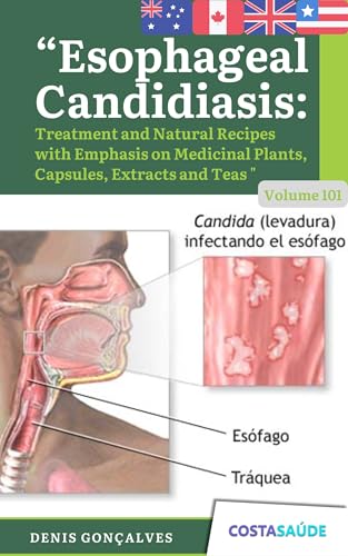 Esophageal Candidiasis : Treatment Natural Recipes with Emphasis on Medicinal Plants Capsules Extracts and Teas - Volume 101 (Treatment and Natural Recipes ... Extracts and Tea Book 4) (English Edition)
