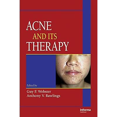 Acne and Its Therapy