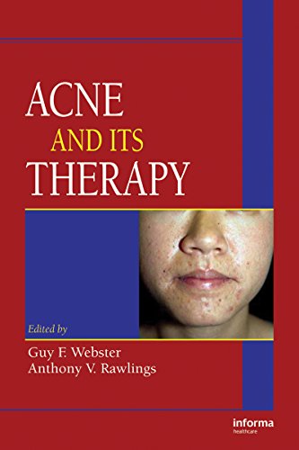 Acne and Its Therapy (Basic and Clinical Dermatology) (English Edition)