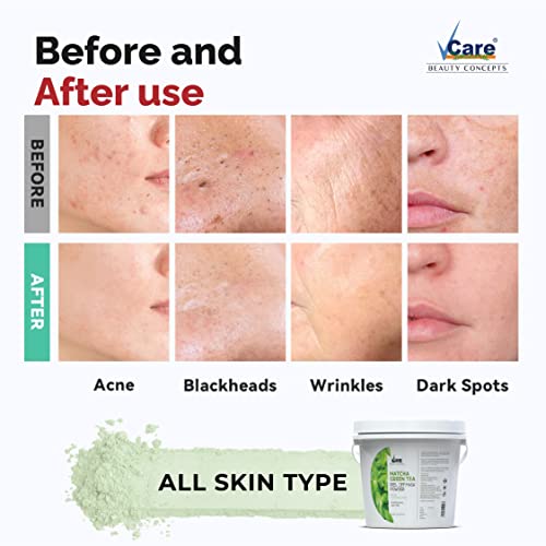 Image of Vcare Jelly Ocean Mineral Peel Off Mask For Facials Skincare |Face Mask Powder 1Kgs - Facial Skin Care Product for Women Smoothing, Moisturizing, Cleansing, Refreshing