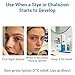 Stye Eye Treatment, Stye Relief Serum for Styes, Chalazions, Blepharitis treatment for eyelids, Relieve Eye Irritation and Swelling, Clear Eyes Redness Relief, Stye Eye Rollerball Drops and Compress