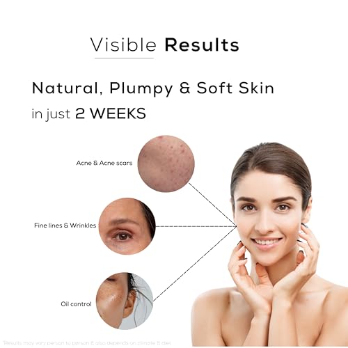 Image of Cica + Niacinamide Face Serum for Acne Marks, Oily & Sensitive Skin | Calms Redness, Balances Oil & Supports Skin Barrier | With Hyaluronic Acid + Zinc PCA | Lightweight Non-Sticky Serum | 30ml