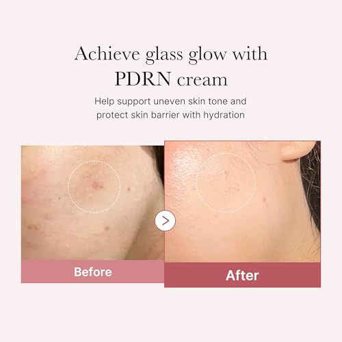 Image of medicube Rose PDRN Pink Hyaluronic Moisturizing Cream | Blemish Relief, Hydration & Elasticity Care - For the Look of Uneven Skin Tone & Pores, Korean Skincare, 1.69 fl. oz.