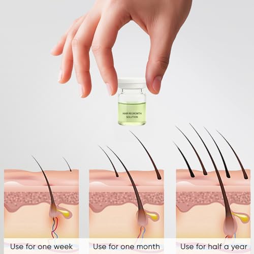 Hair Regrowth System, Natural Formula for Thicker, Fuller Hair | Stimulates Hair Follicles, Reduces Thinning -with Ginseng Root, Eclipta  Prostrata  Extract & Peppermint Oil