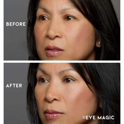 Eye Magic Premium Instant Eyelid Lift (L/XL-Refill). Look Younger Instantly | Made in America - Lifts and Defines Droopy, Sagging, Hooded Eyelids For A Youthful Look - Thumbnail 3