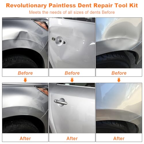 BESTGLOAL 135pcs Dent Puller Kit