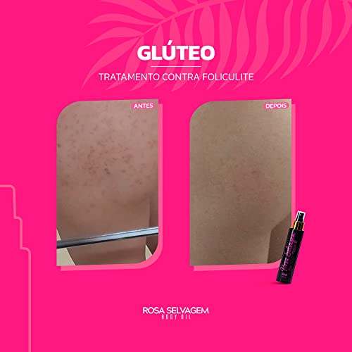 Óleo Rosa Selvagem Clareador de Manchas e Foliculite