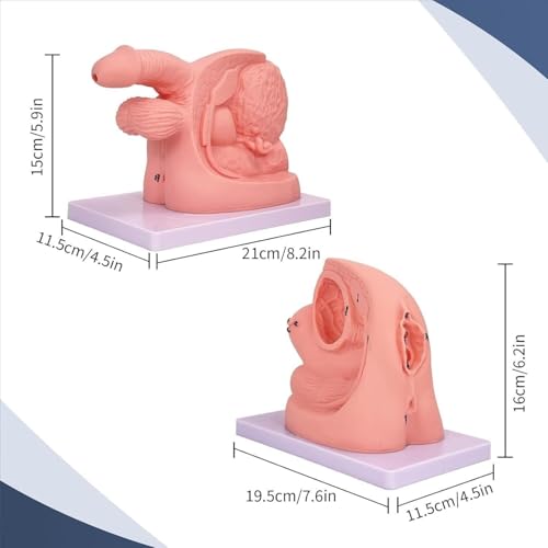 Modèle urinaire AMITD complet pour affichage didactique et démonstration médicale - 7