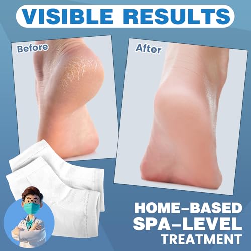 Image of TEAWOO 6 Pairs White Moisturizing Heel Socks for Cracked Heel Treatment
