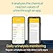 Licote Pet Urine Test Kit for Dogs & Cats Analyzer Device + 25 Test Strips | at-Home Health Check | Detects 10 Urinary Conditions | Easy-to-Use Smart App | Veterinary Grade