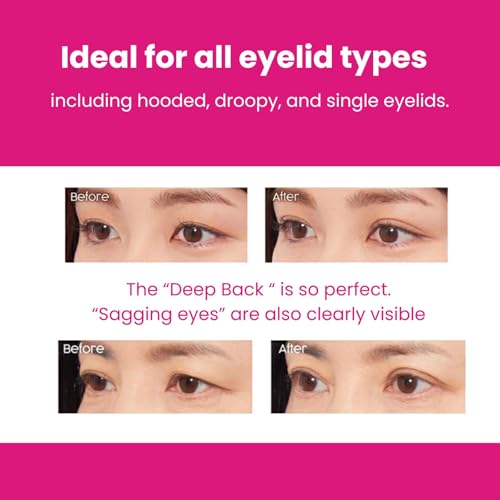 D-UP Wonder Eyelid Tape,Waterproof & Ultra-Thin Transparent Tape, Double Sided Adhesive, Invisible Blend Double Eyelid Lift Strips for Droopy Eyes, Mine Type, 180pcs/pack - Thumbnail 6