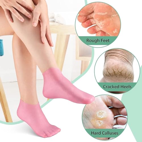 Image of Silicone Socks for Women, Crack Heel Repair Socks, Spa Gel Socks for Women, Silicon Socks, Silicone Socks for Men, Foot Hydration Socks Vitamin E- Multicolour (foot moisturizer socks)