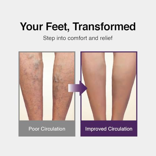 Acupressure Slippers for Sensitive Feet Women Reversible – Foot Comfort Products Inspired by Plantation Tool Massager Design for Everyday Leg Refreshment2