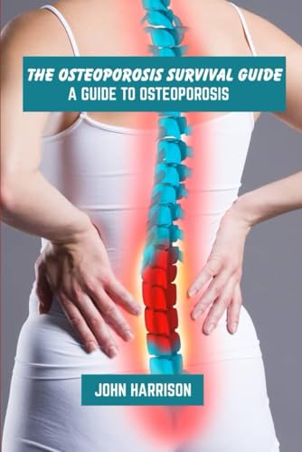 The osteoporosis survival guide: A guide to osteoporosis