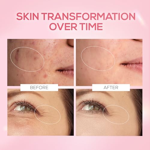 Image of RENEE Pink Therapy PDRN Pink Peptide Face Serum For Glowing, Radiant Skin | Hydrates, Boosts Collagen, Evens Skin Tone | Lightweight, Quick Absorbing | Hyaluronic Acid & Niacinamide Infused | 30 ml