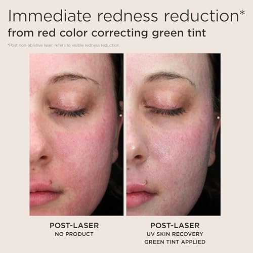 EltaMD UV Skin Recovery Green Tint All Mineral, Redness Reduction, Sensitive Skin Face Sunscreen SPF 50 - Image 7
