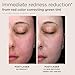 EltaMD UV Skin Recovery Green Tint All Mineral, Redness Reduction, Sensitive Skin Face Sunscreen SPF 50