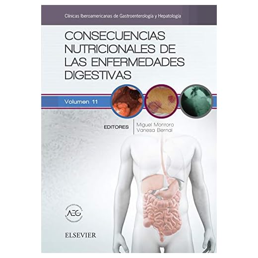 Consecuencias nutricionales de las enfermedades digestivas: Clínicas Iberoamericanas de Gastroenterología y Hepatología vol.11