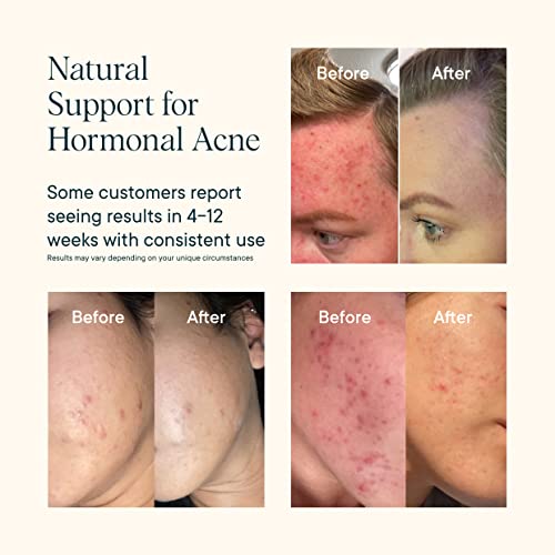 Ora Organic Natural Hormone Balance Support & Hormonal Acne Relief for Women - Support Skin, Mood, Energy, PMS & Menopause - Formulated with Ashwagandha, Maca, Burdock Root, Cordyceps & Acerola Cherry - Image 3