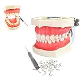 dental praxisklinik gelsenkirchen Standard Zahnimplantat Zahnmodell