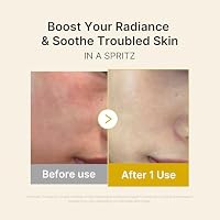 medicube Jelly Mist Serum with Kojic Acid Turmeric | 2-in-1 Daily Facial Spray and Serum | Vitamin C, Turmeric, Panthenol for Hydrating, Calming Care | Lightweight, Refreshing Mist | 2.02 fl.oz — image 4
