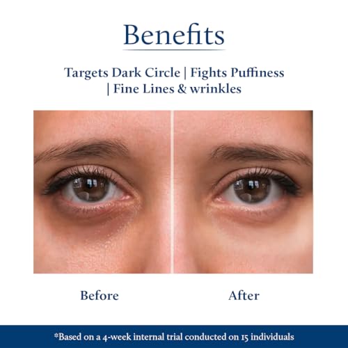 Image of Blue Nectar Under Eye Cream for Dark Circles, Wrinkles, Fine Lines & Puffiness for Women | Natural Niacinamide from Papaya, Potato & Wheatgerm for Even Skin Tone (19 Herbs, 15g)