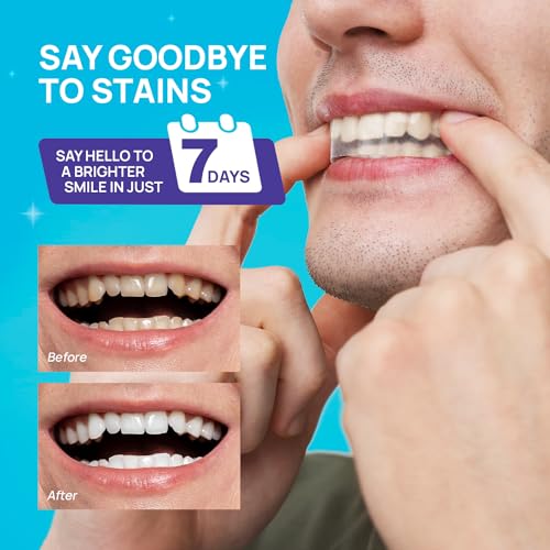 Whitebite Pro Teeth Whitening Strips 48 Strips (24 Treatments) | Non Sensitivity | Peroxide Free thumb #2