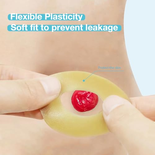 TNTNDAY 20 PCS Moldable Ostomy Barrier Rings, Elastic Skin Extender Rings, 2mm Thickness Medical Hydrocolloid Ostomy Bag Supplies, Better Seal No Leaking Skin Barrier Strips for Colostomy Bags - Thumbnail 3