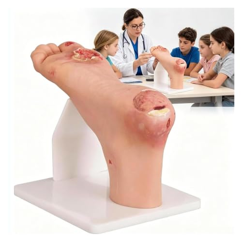Pathologie de l'ulcère du pied diabétique et simulateur de soins infirmiers
