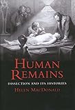 Human Remains