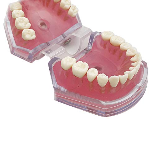 Dental Removable Teeth Model Full-Mouth Tooth Extraction Model or Soft Gum Simulation Cheek (Transparent Tooth Extraction Model)